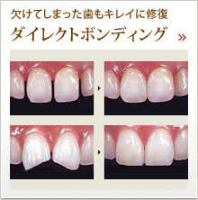 審美歯科