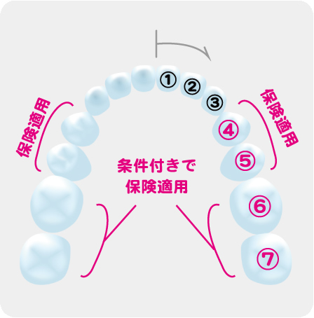 金属アレルギー症状の方もcad Cam冠 保険適用 治療を受けられます 高木歯科医院